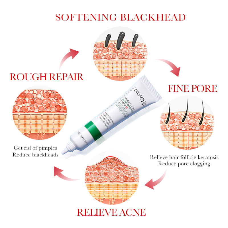 1/2/3 sztuk BIOAQUA kwas salic – Azelaic Acid Cream recenzja i cena