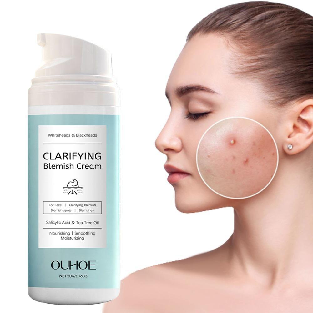 Krem do twarzy z kwasem salicy – Azelaic Acid Cream recenzja i cena