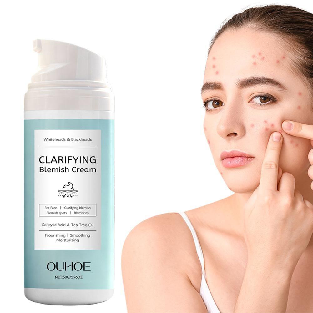 Krem do twarzy z kwasem salicy – Azelaic Acid Cream recenzja i cena